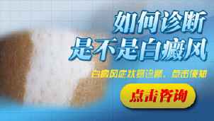 白癜风有哪些诊断的方法呢