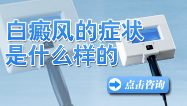 昆明专业的白癜风医院:初期的白癜风症状什么样的